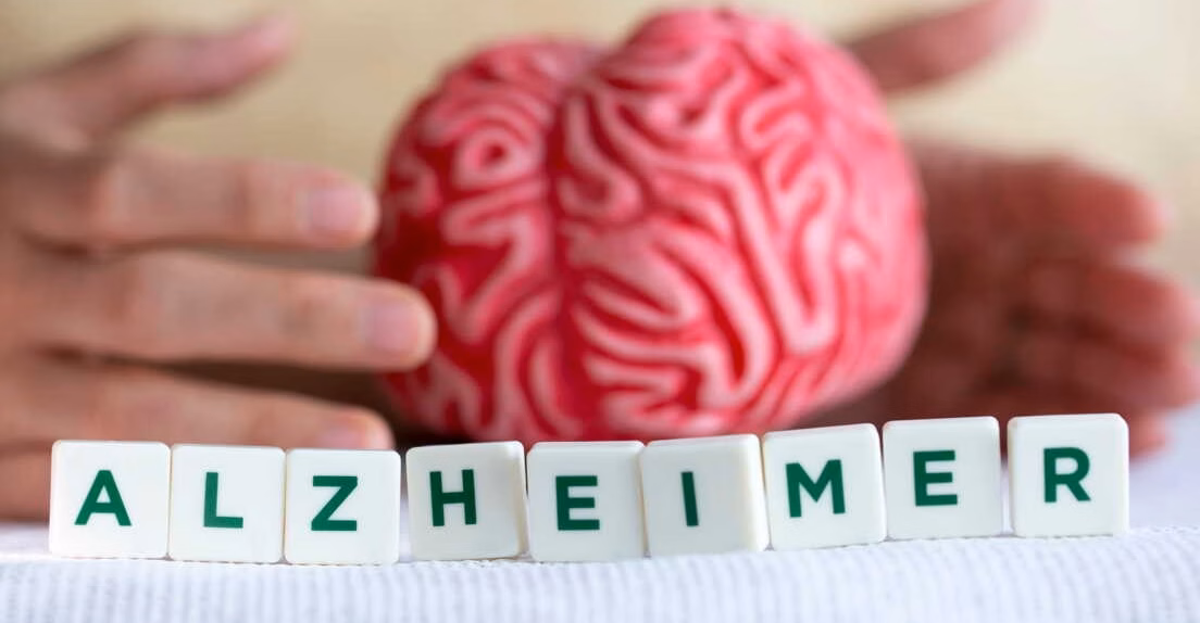 Alzheimer : des résultats prometteurs révélés par un somnifère courant dans une nouvelle étude